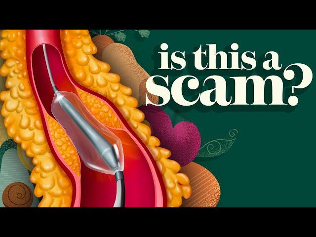 Is Angioplasty a Scam? The Terrifying Truth | Dr. McDougall Health & Medical Center