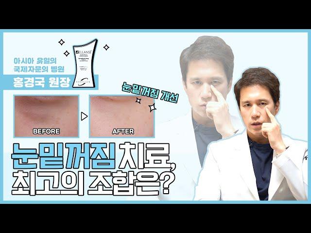 눈밑지방 필러에도 최고의 조합이 있다?  [클리니크후즈후]