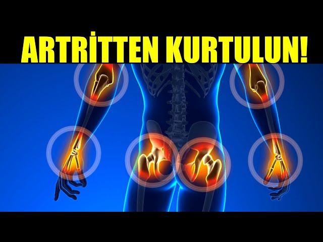 ALTI ADIMDA ARTRİTTEN KURTULUN!