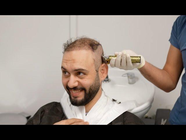 Best Hair Transplant Clinic in Istanbul | Dr. Bayer Clinics 