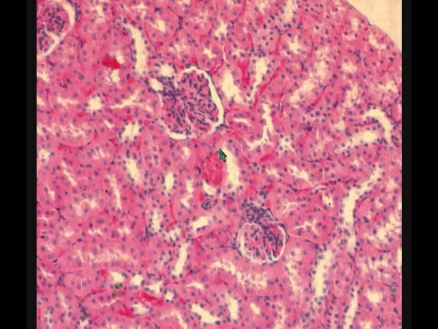 ПОЧКА   KIDNEY  гистологическое строение