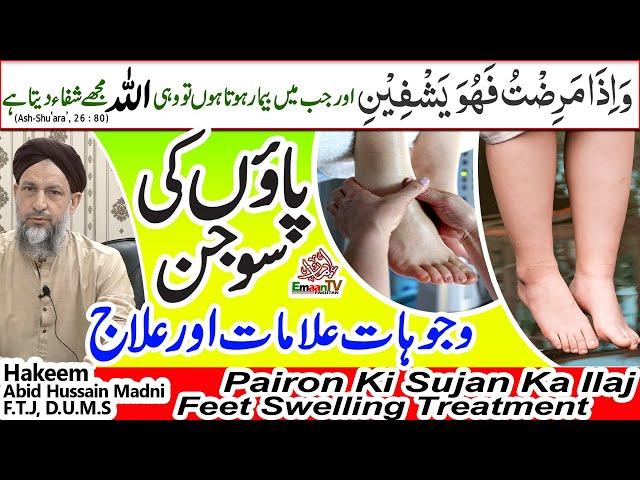 paon ki sujan ka ilaj | pairon ki sujan ka ilaj, Feet Swelling Treatment, Paon mein Sujan ki wajohat