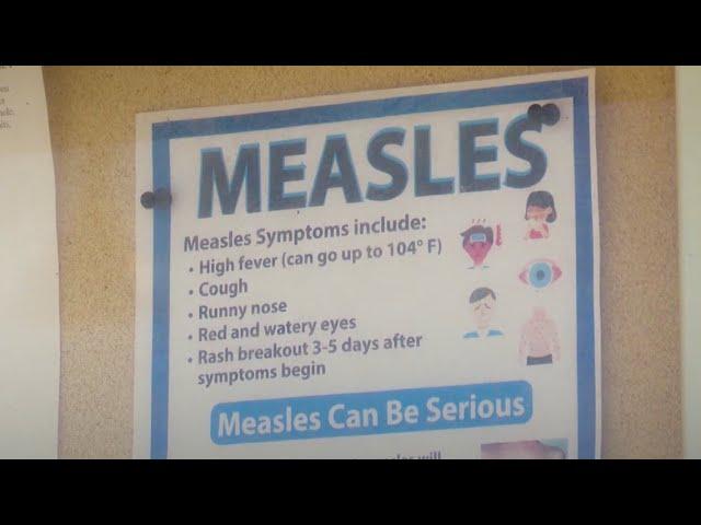 Measles outbreak growing in Texas, prompting concerns from parents across the US