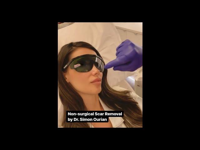 Scar Removal by Dr  Simon Ourian