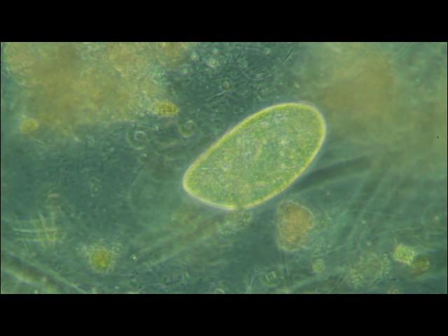 Paramecium Zeiss Primostar 400x phase contrast