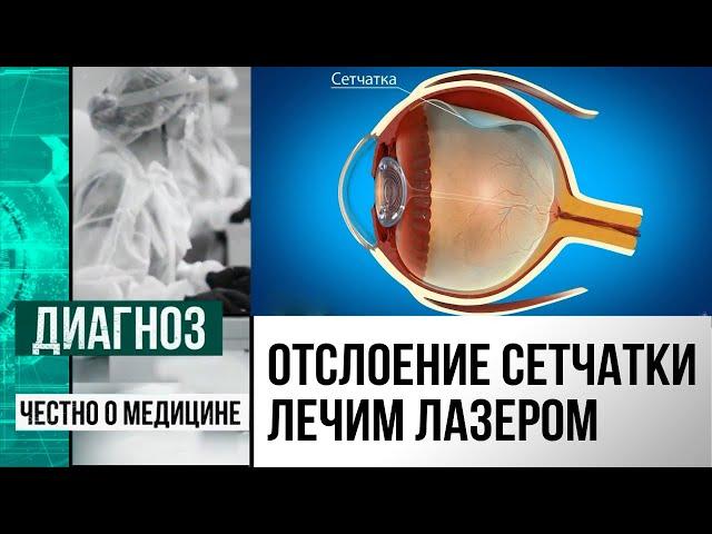 Невидимая опасность: что такое периферическая дистрофия сетчатки | Диагноз