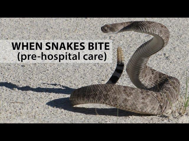 When Snakes Bite: Pre-Hospital Care