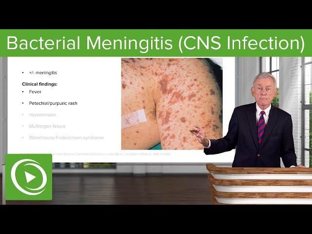Bacterial Meningitis (CNS Infection) – Infectious Diseases | Lecturio