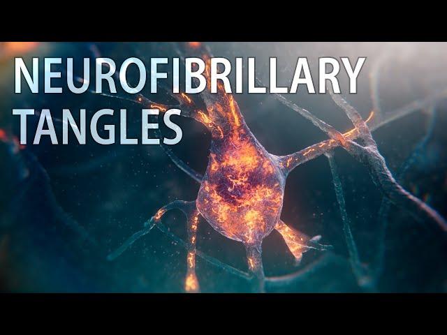 Tau & neurofibrillary tangles animation | Alzheimer’s disease | medical animation