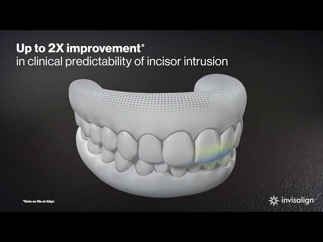 Invisalign® G8 | SmartForce Aligner Activation | Align Technology