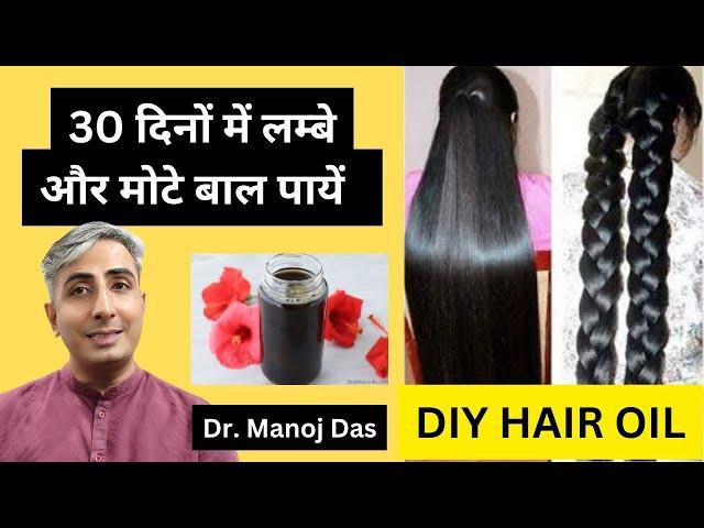 बालों को जल्दी लम्बा और घना कैसे करें। HOW TO GROW HAIR FAST I DR. MANOJ DAS