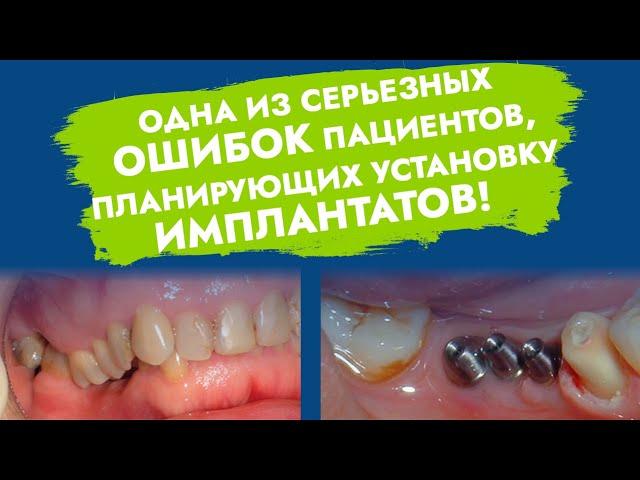 Имплантация зубов. Ошибки и осложнения.