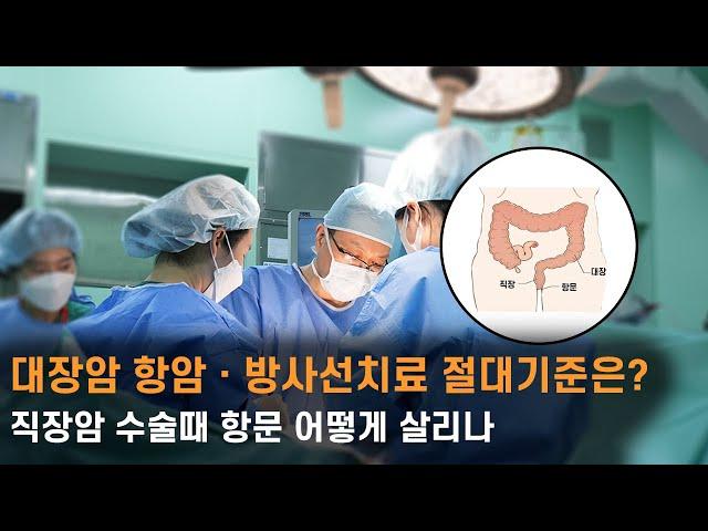 대장암 항암ㆍ방사선치료 절대기준은? 직장암 수술때 항문 어떻게 살리나
