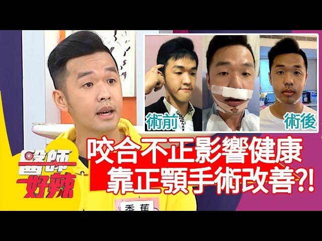 咬合不正影響健康，靠正顎手術改善？！【醫師好辣】20200121 part3 EP883 陳保仁 趙國翔