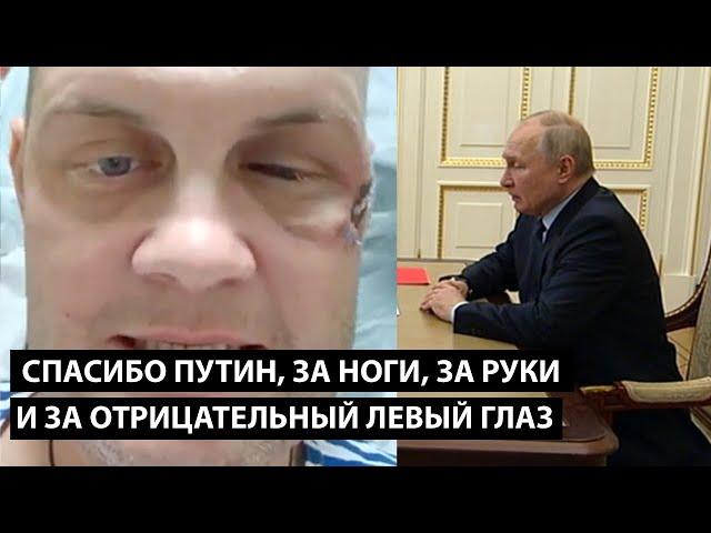 Спасибо Путин! За сломанные руки, ноги и за отрицательный левый глаз