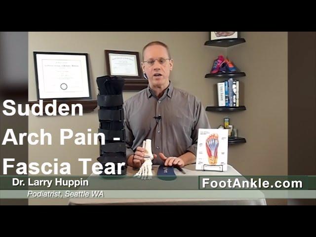 Sudden Severe Arch Pain With Seattle Foot Doctor Larry Huppin