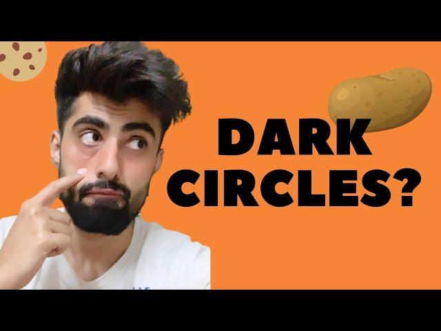 आँखों के काले घेरे जड़ से ख़त्म करें, Remove Dark Circles Permanently || Mridul Madhok