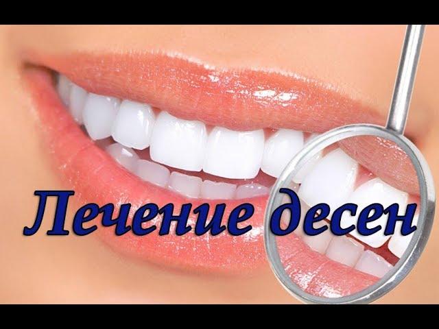 Всё о лечении дёсен и их болезнях