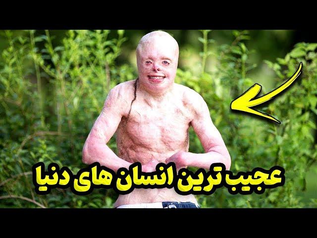 عجیب ترین انسان های دنیا که باور نمیکنید وجود داشته باشن!