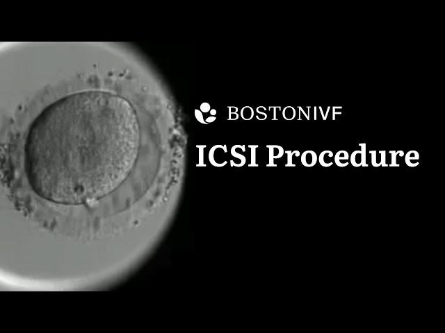 ICSI Procedure Explained | Science at Boston IVF