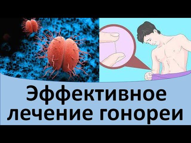 Эффективное лечение гонореи