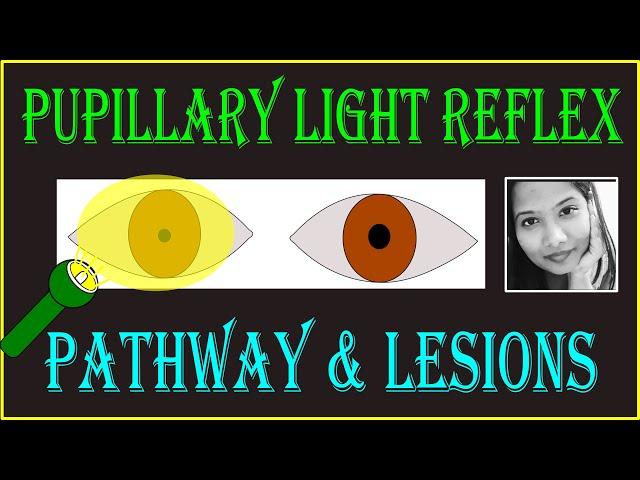 Pupillary Light Reflex – Pathway & Lesions | Neuro ophthalmology