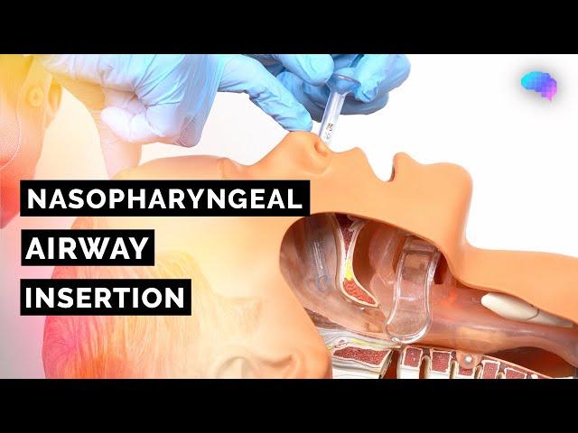 Nasopharyngeal Airway (NPA) Insertion | ABCDE Emergency | OSCE Guide | UKMLA | CPSA