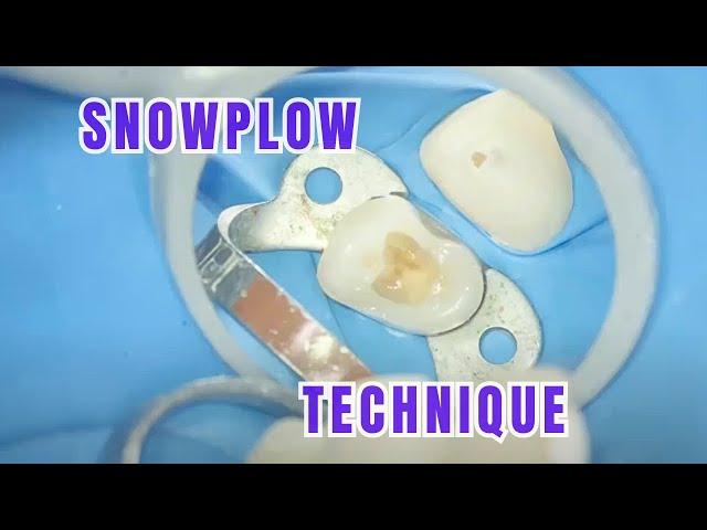 Snowplow Technique 