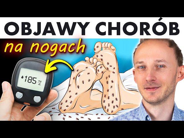 7 objawów na nogach, które ostrzegają przed chorobami