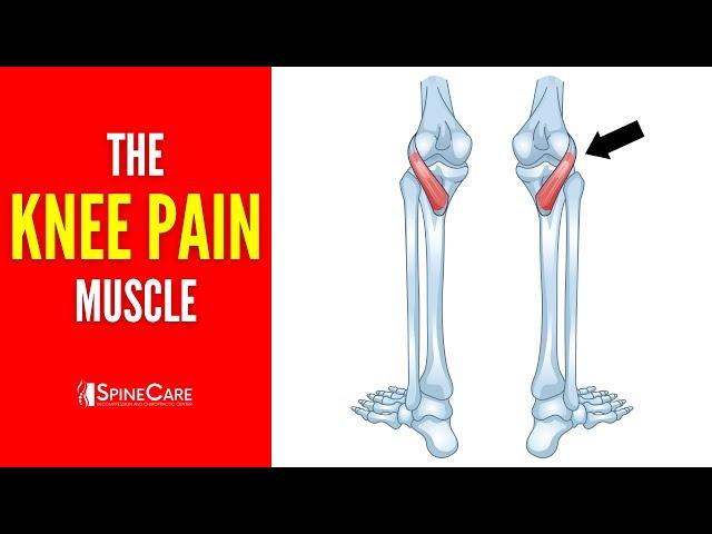 The Knee Pain Muscle (How to Release It for INSTANT RELIEF)