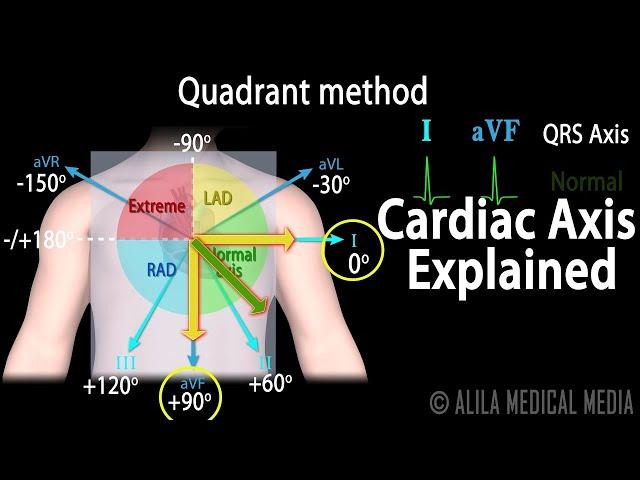 Cardiac Axis Interpretation, Animation.