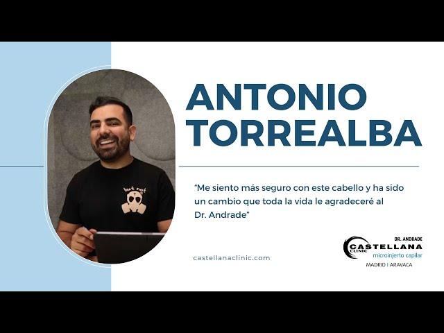 Antonio Torrealba cuenta su experiencia de trasplante capilar en Castellana Clinic.