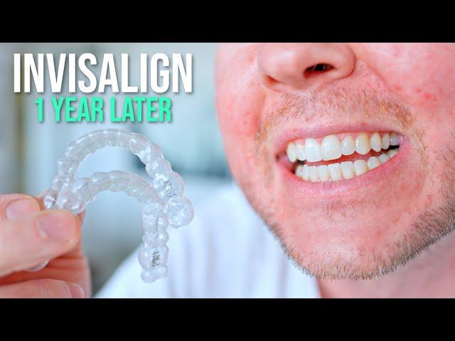 10 Things I Wish I Knew BEFORE Getting Invisalign!