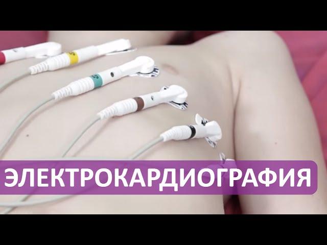 ЭКГ - электрокардиография для детей в клинике Фэнтези