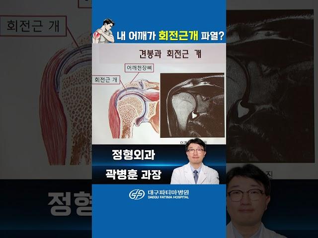 내 어깨가 회전근개 파열??? -대구파티마병원 정형외과 곽병훈 과장 #대구파티마병원 #회전근개