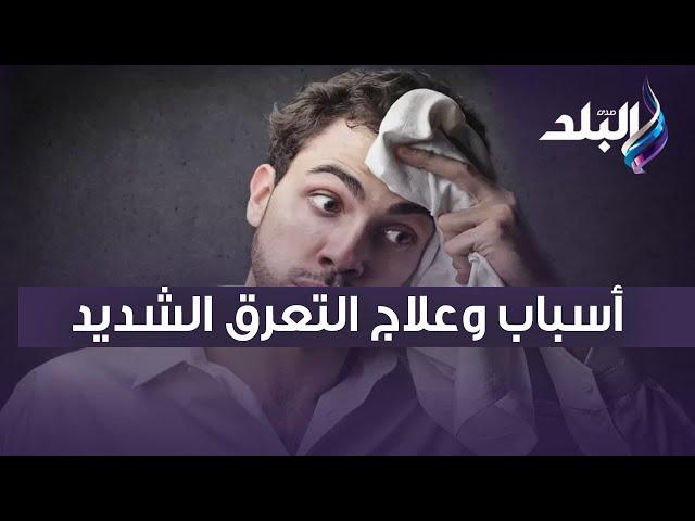 الدكتور حسام موافي يكشف أسباب وعلاج التعرق الشديد