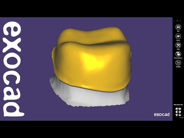 exocad Video Tutorial: Introduction to Basic Features  / Offset Coping Design