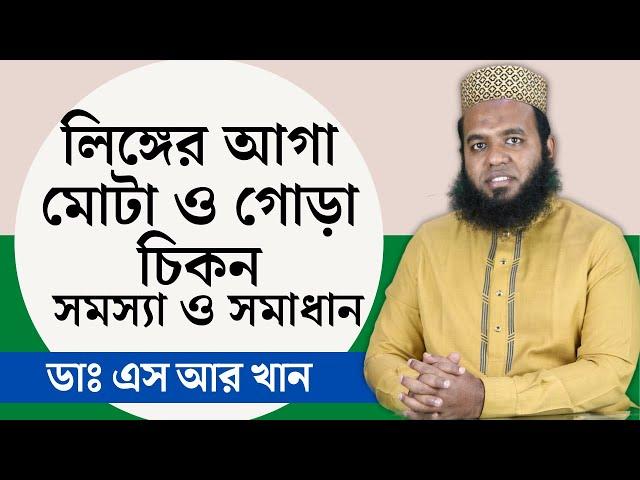 লিঙ্গের আগা মোটা ও গোড়া চিকন সমস্যা ও সমাধান #ডাএসআরখান || #DrSRKhan