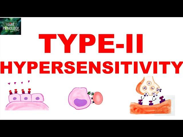 Type II Hypersensitivity | Antibody mediated Hypersensitivity | Mechanism | Examples