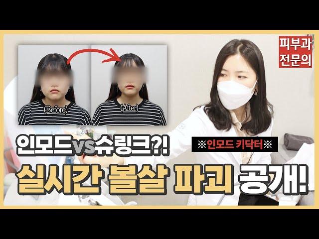 리프팅 끝판왕, 인모드 vs 슈링크! 충격적인 반반 시술 결과ㅣ노남경의 피부클래스