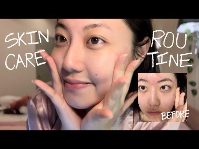 GLOWUP VLOG | Skincare Routine That Cleared My Face (ENG sub)