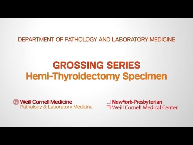 Grossing Hemi-Thyroidectomy Pathology Specimens | Department of Pathology and Laboratory Medicine