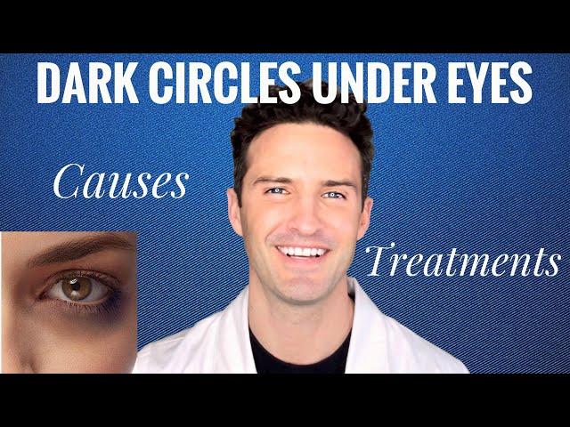 Dark Circles Under Eyes: Causes & Treatments