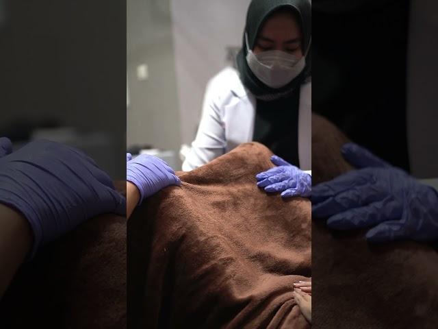 Treatment untuk mengencangkan otot miss V