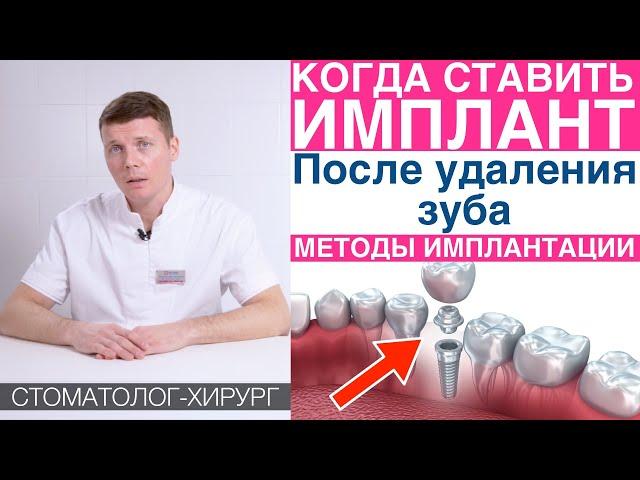 Когда устанавливать зубной имплант после удаления зуба? Методики имплантации зубов.