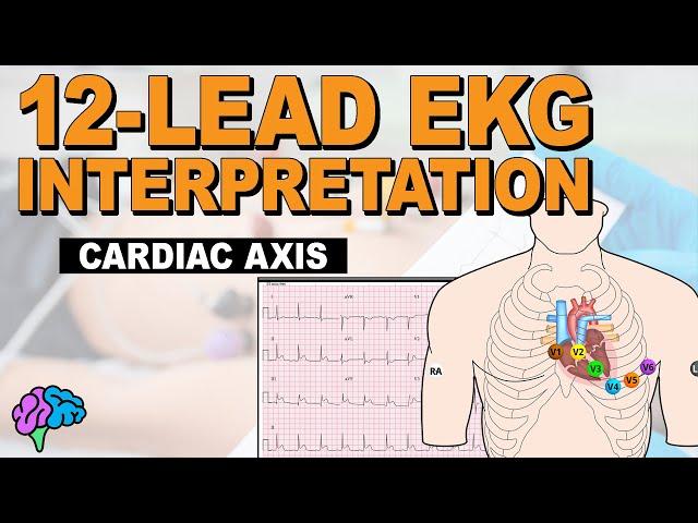 Understanding Cardiac Axis and Deviations - 12-Lead EKG