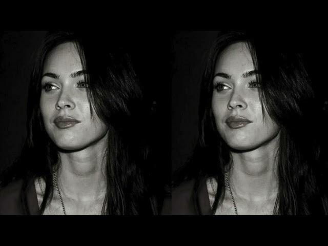 forehead botox, brow lift, fox eye lift, malar fat lift, etc (calm water sounds meditation & study)