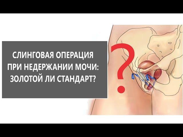 Слинговая операция при недержании мочи у женщин: золотой ли стандарт?