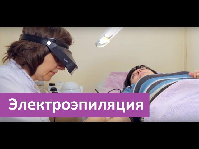 Электроэпиляция. Сделать электроэпиляцию в ЭпилСити.