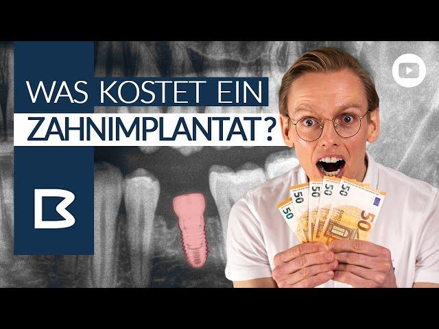 ZahnIMPLANTAT KOSTEN? Was muss ICH zahlen? Was zahlt die Krankenkasse? Alles GENAU erklärt!